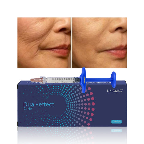 CaHA Dual-effect Injectable Calcium Hydroxylapatite Hybrid Filler