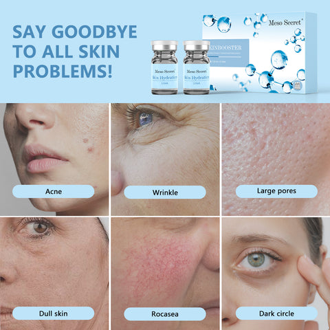 Injectable Hyaluronic Acid Filler Meso Secret Skinbooster 3.5ml*2 Vials