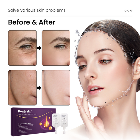 Popular Pure Sterile Hyaluronic Acid 4D Serum 10 vials/box