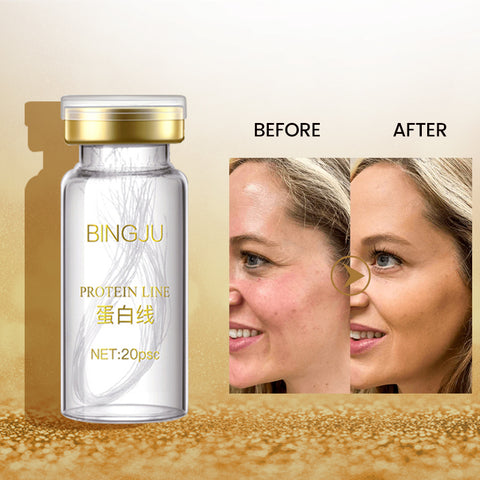 Gold Portein Face Filler Absorbable Collagen Protein Thread