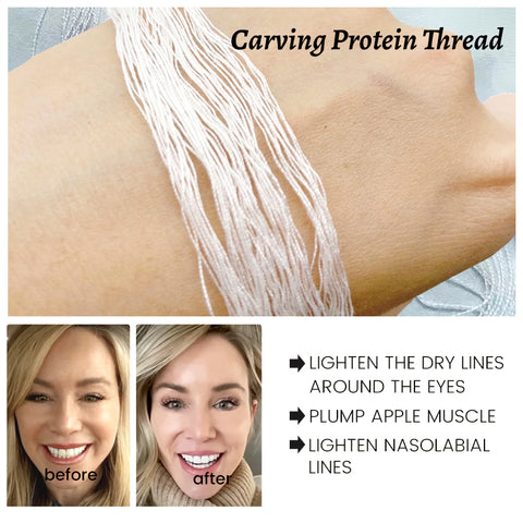 Gold Absorbable Collagen Protein Threads